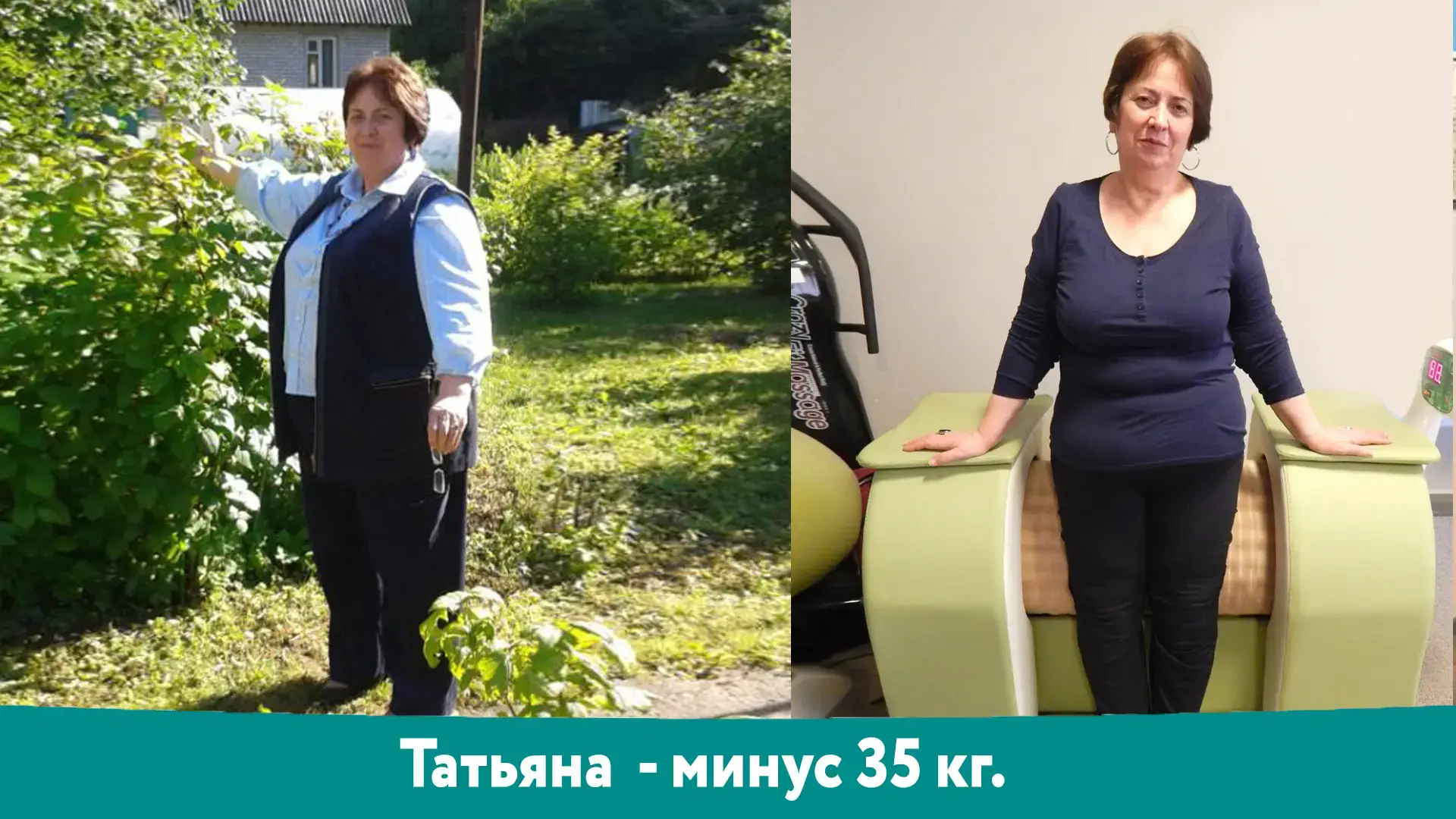 Татьяна: результат снижения веса −35 кг, фотография до и после